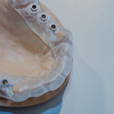 Restorative Implants